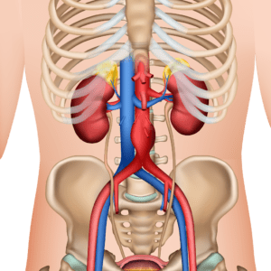 aortic aneurysm treatment