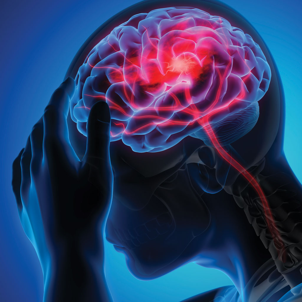 reduce your risk for stroke