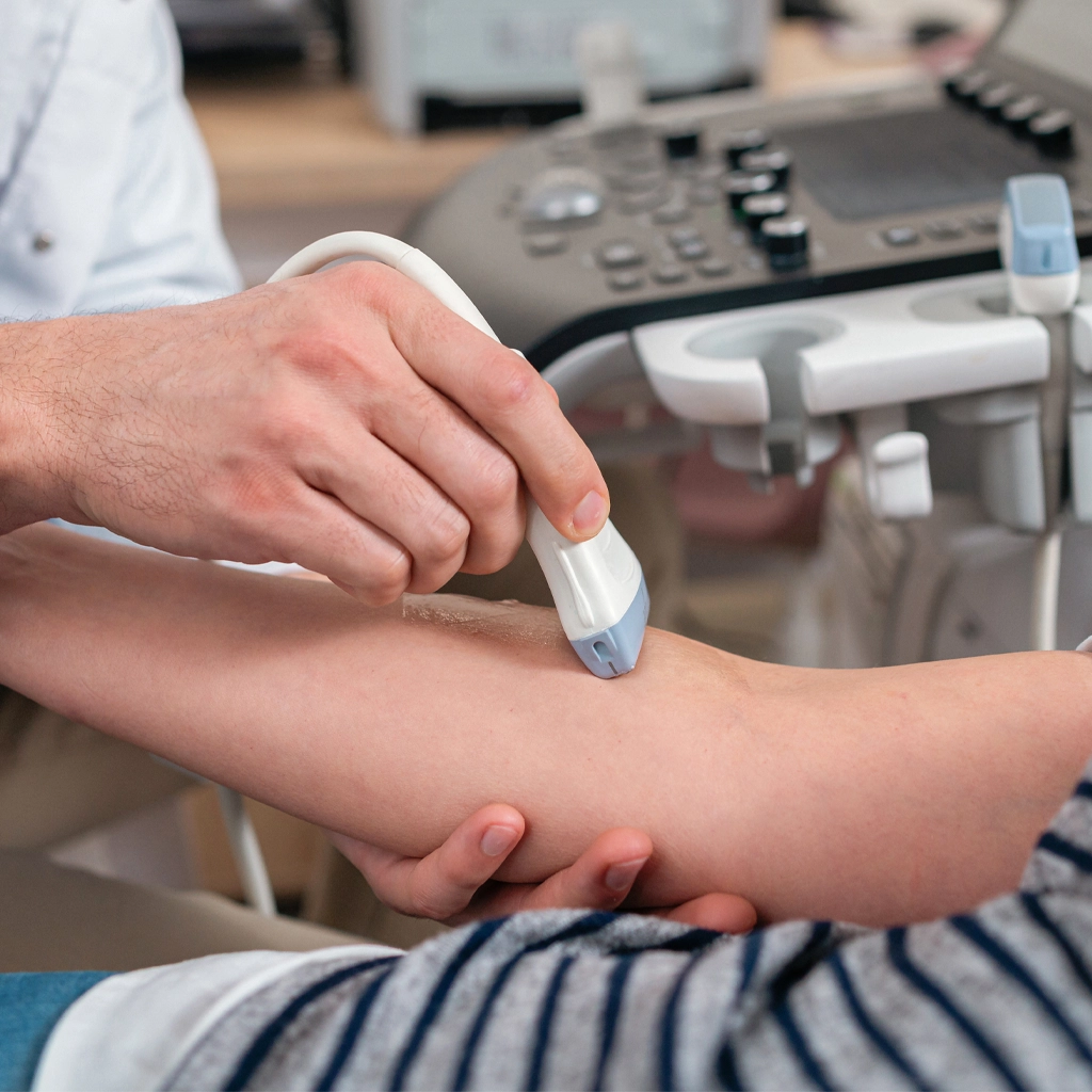 vascular testing