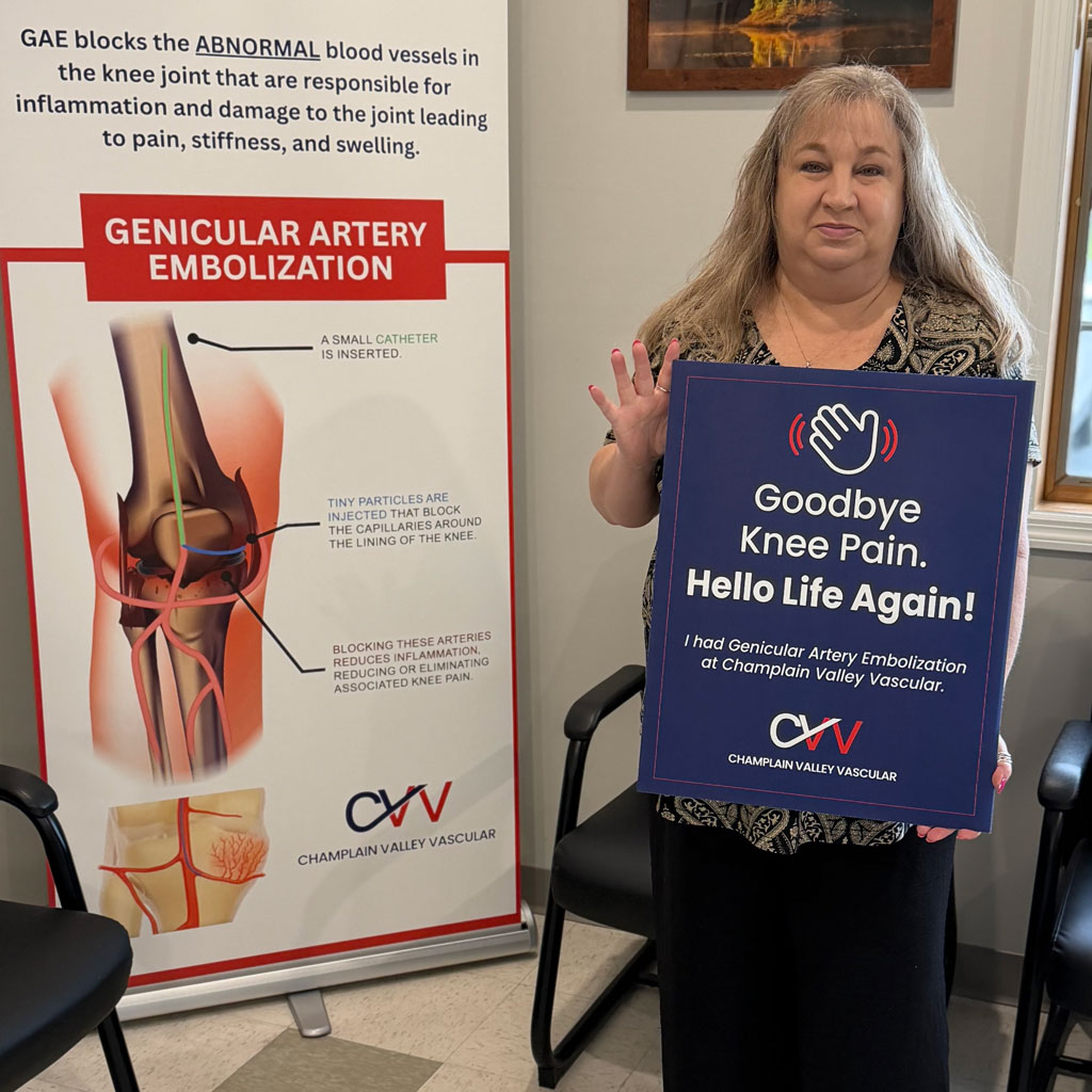Lisa After Genicular Artery Embolization